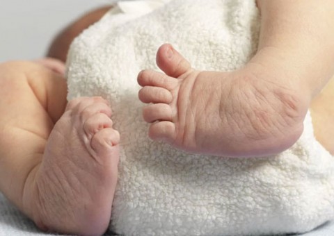 Susam pretende zerar fila de tratamento do Pé Torto Congênito