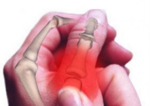 Elime todas as dores nas articulações com 16 dicas naturais 