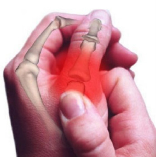 Elime todas as dores nas articulações com 16 dicas naturais 