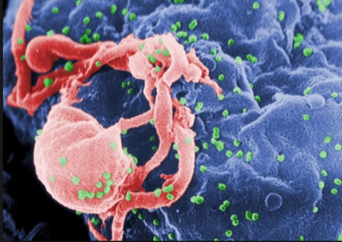Cientistas destroem vírus HIV com células de defesa modificadas