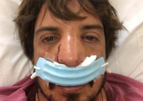 Surfista brasileiro desafia onda gigante e sofre grave acidente no Havaí