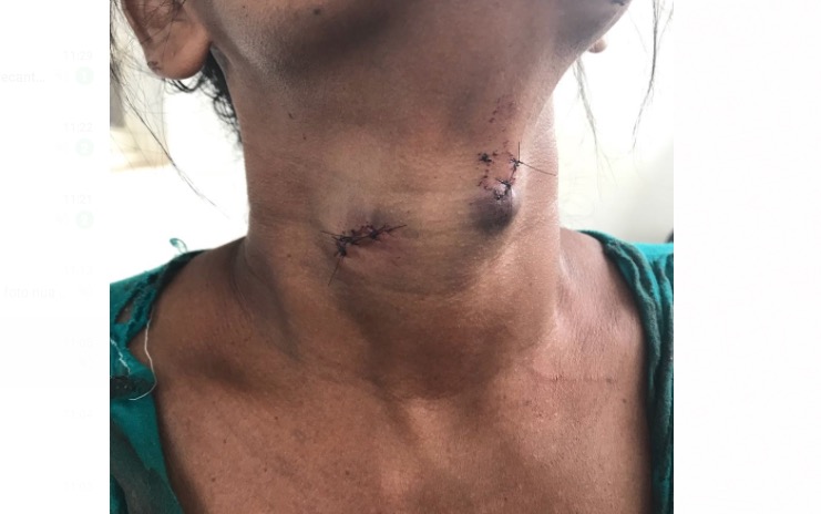 Enfurecida, mulher esfaqueia vizinha e é amarrada por populares no Amazonas