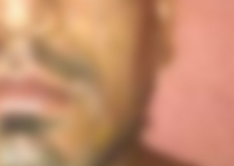 Jogador do Peñarol tem rosto desfigurado após ser atingido por fogo de artifício