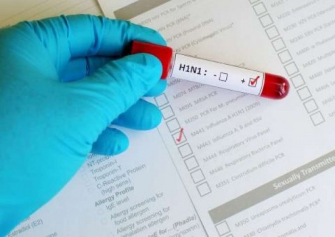 FVS descarta surto de gripe suína no Amazonas e revela doença de pacientes