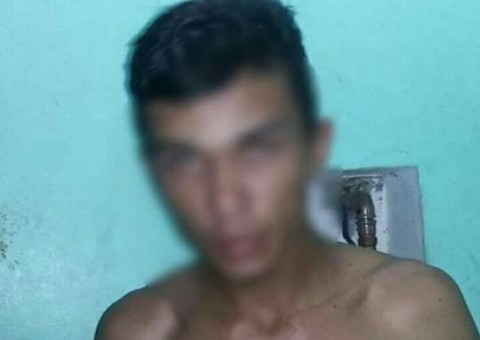 Com gargalo de garrafa, jovem assalta e fura professor no Amazonas
