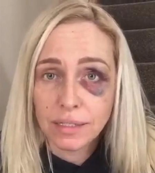 Lutador é acusado de assediar e agredir ex-Big Brother