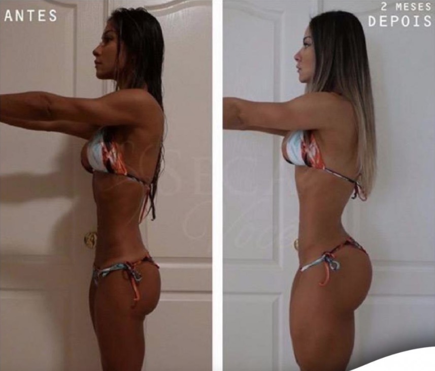 Mayra Cardi choca ao mostrar antes e depois de magreza extrema