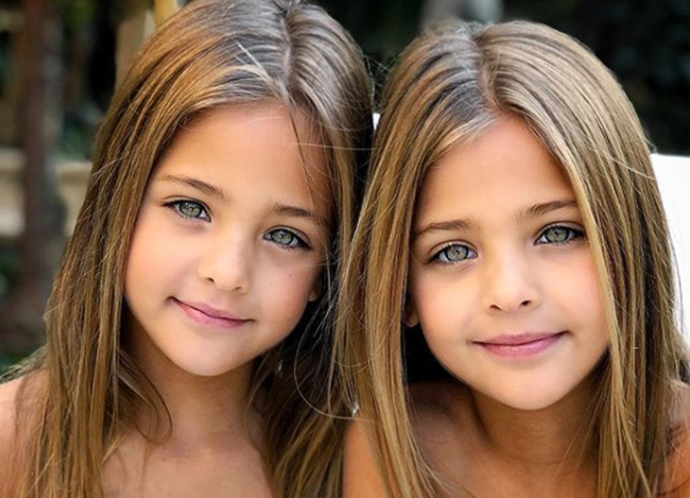   Gêmeas de 7 anos chocam mundo com beleza rara; Veja fotos