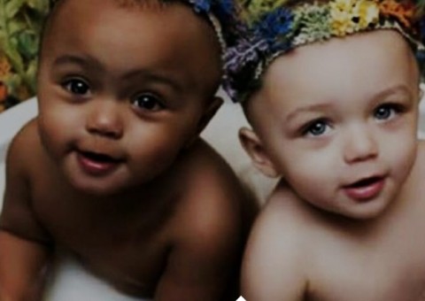 Primeiras gêmeas do mundo com cores de pele diferentes já são adultas; Veja