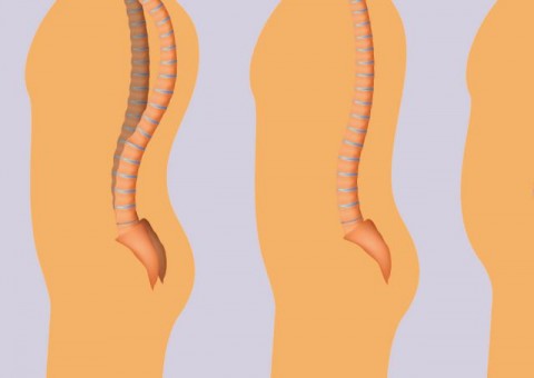 Endometriose, infecções e mais doenças e lesões que podem causar dor na lombar