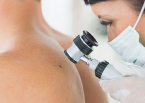 Susam realiza mutirão dermatológico com 400 vagas em Manaus