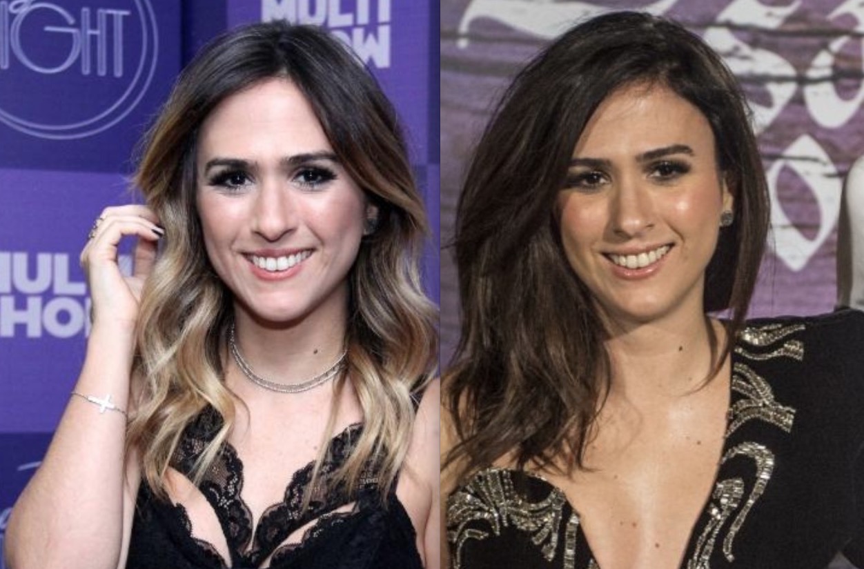  Com o rosto diferente, Tatá Werneck revela que fez cirurgia após levar soco