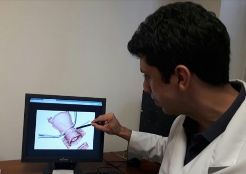 FCecon realiza cirurgia inédita para tratamento de câncer na rede pública estadual