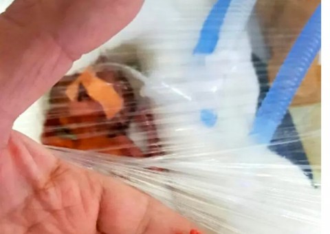 Bebê nasce pesando menos de 400 gramas e surpreende médicos