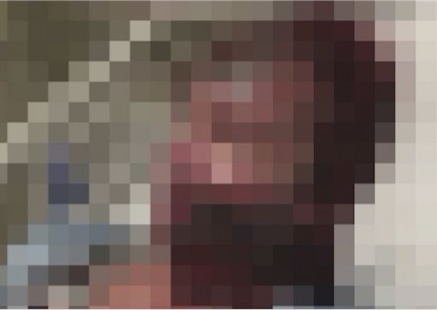 Mulher que teve rosto desfigurado com ácido em suposto ataque revela mentira