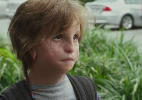 Síndrome de Treacher Collins: conheça a doença rara que inspirou o filme Extraordinário