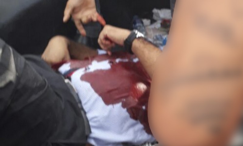 Trabalhador fica em estado grave após ser baleado durante tiroteio em avenida de Manaus