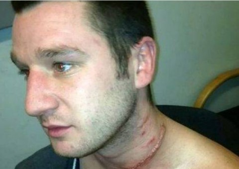 Mulher enciumada ataca melhor amigo do namorado com faca