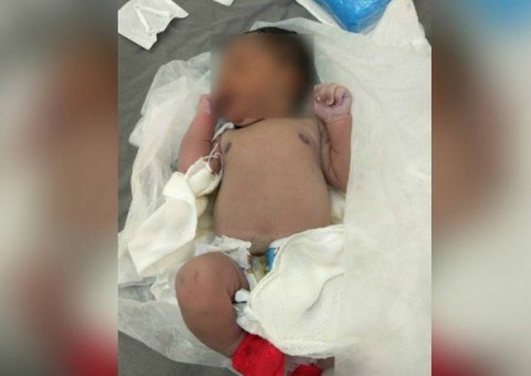 Recém-nascida é encontrada por catador de lixo em Guaratiba