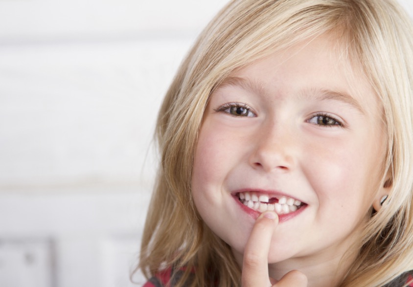 3 erros que a maioria dos pais comete quando os dentes da criança estão moles