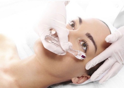 Microagulhamento: Conheça o procedimento que reduz manchas na pele e até estrias e rugas