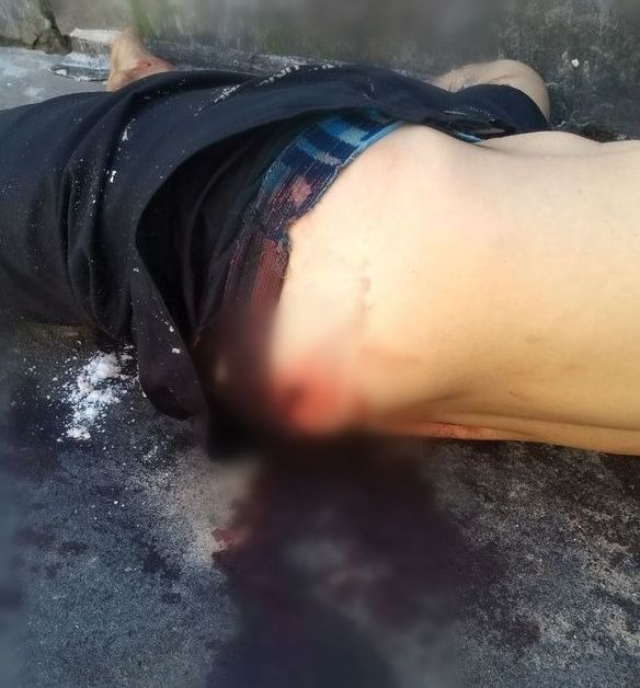 Suspeito de assalto é baleado nas nádegas por justiceiro e acaba preso em Manaus