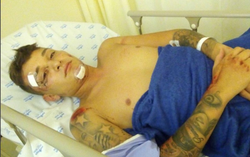 MC Gui sofre acidente de moto durante férias