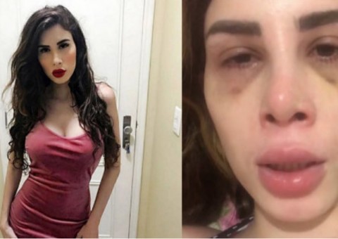 Manauara se fantasia de Camilla Uckers no Carnaval e youtuber comenta