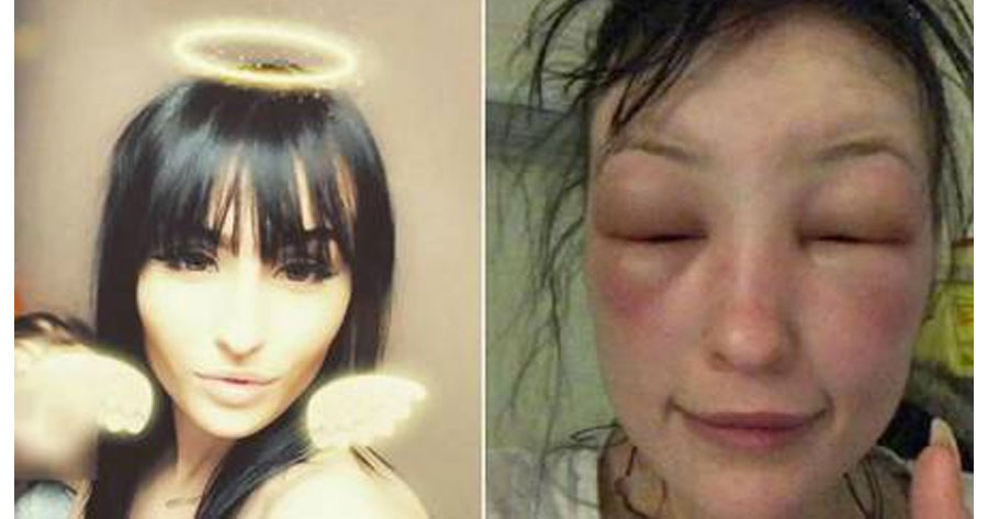 Mulher fica irreconhecível após aplicar tintura de cabelo e choca internet