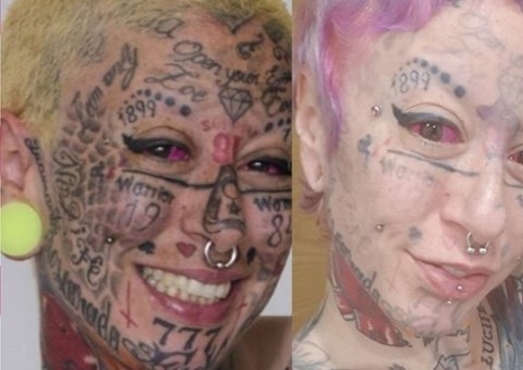 Mulher mais tatuada do mundo decide retirá-las; veja resultado