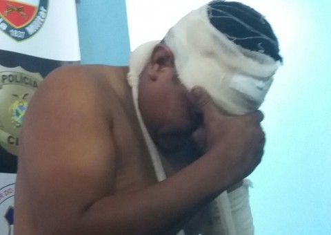 Polícia faz revelação sobre motorista acusado de matar dois homens atropelados em Manaus