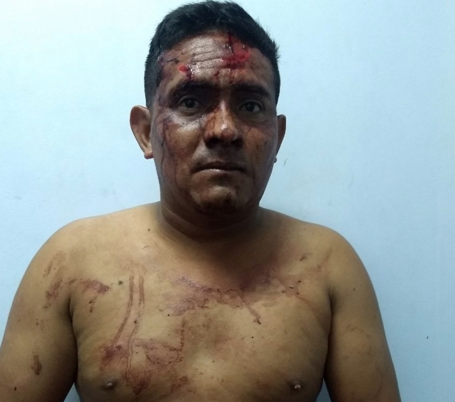 Motorista que matou dois atropelados no Centro tem prisão preventiva decretada