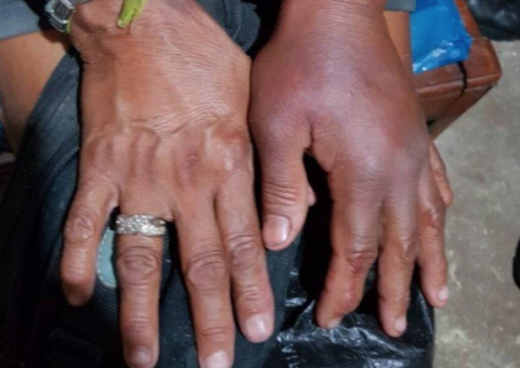 Idosa é torturada e mantida refém por traficantes da favela Kelson's, na Penha