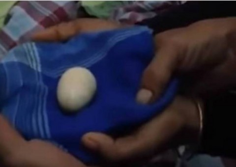 Após expelir 20 ovos, adolescente põe ovo na frente de médicos
