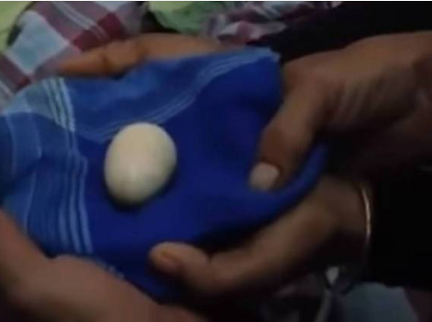 Após expelir 20 ovos, adolescente põe ovo na frente de médicos