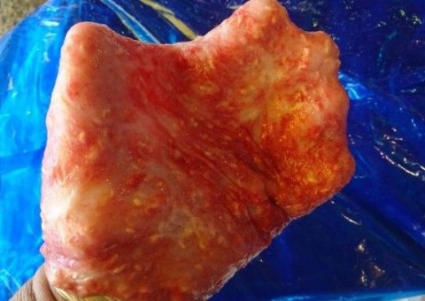 Pescador contrai infecção por se masturbar com estômago de peixe