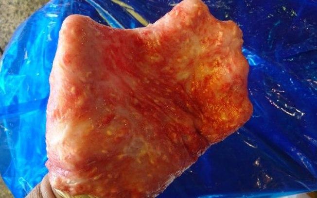 Pescador contrai infecção por se masturbar com estômago de peixe