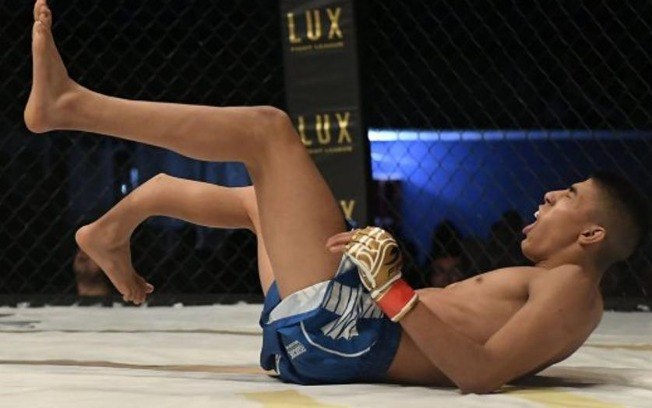 Lutador de MMA sofre fratura bizarra à la Anderson Silva. Veja o vídeo
