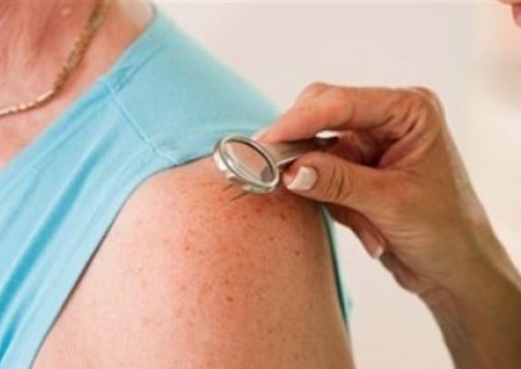 Campanha de Combate à Hanseníase inicia na próxima quinta em Manaus