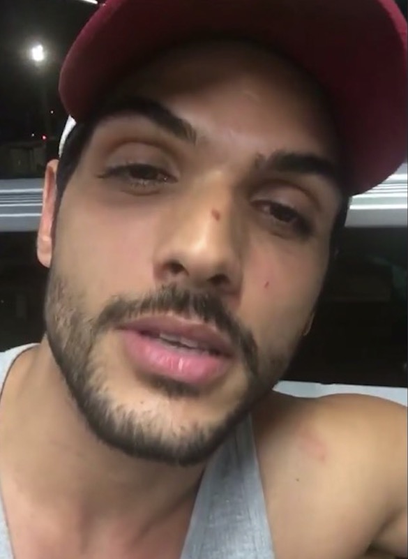 Ex-BBB Lucas se pronuncia após Ana Lúcia aparecer sem aliança