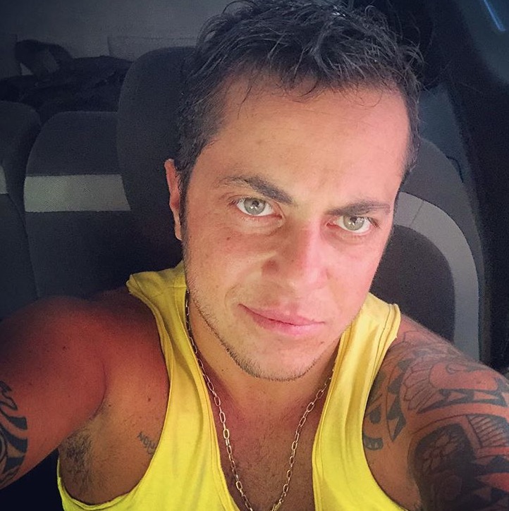 Thammy Miranda começa a ficar calvo e faz desabafo