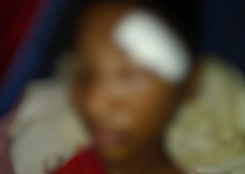 Brincadeira entre estudantes termina com aluno passando por cirurgia no rosto no Amazonas