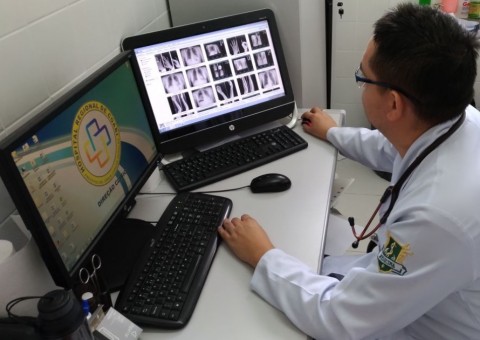 Prefeitura de Coari informatiza setor de radiografia e economiza anualmente R$156 mil