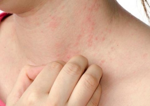 Usar roupa direto da loja sem lavar pode causar esses 4 problemas