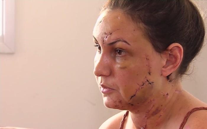 No motel: Jovem conta que foi perfurada pelo namorado morto