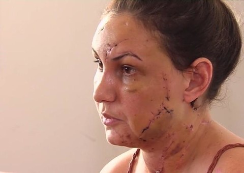 No motel: Jovem conta que foi perfurada pelo namorado morto