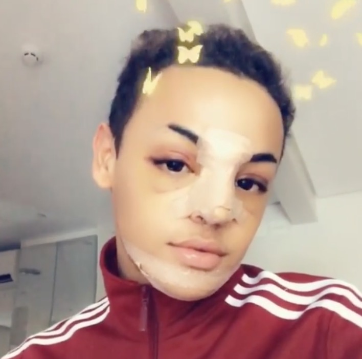 Pabllo Vittar passa por três cirurgias no rosto