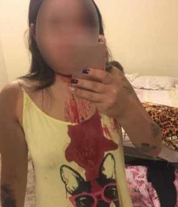 Mulher leva marteladas na cabeça após ter casa invadida por ex-companheiro