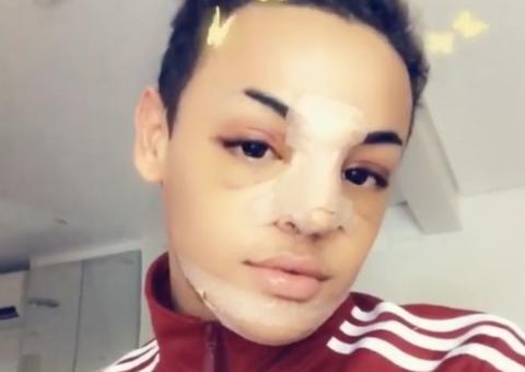 Pabllo Vittar revela resultado de cirurgias no rosto 'Ficou bafo'