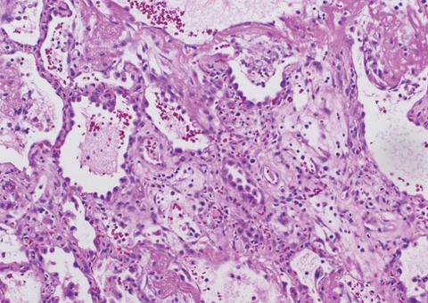 Cientistas anunciam a descoberta de um novo órgão do corpo humano, o interstício